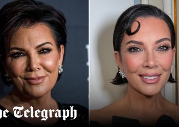 Kris Jenner: “100 ming $ yuz liftim – bu men uchun chiroyli qarish!”