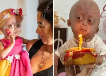 Kamyob kasallik bilan kurashgan 5 yoshli bloger vafot etdi