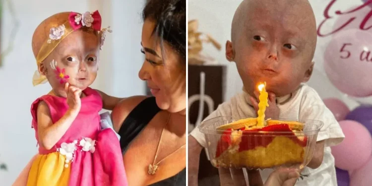 Kamyob kasallik bilan kurashgan 5 yoshli bloger vafot etdi